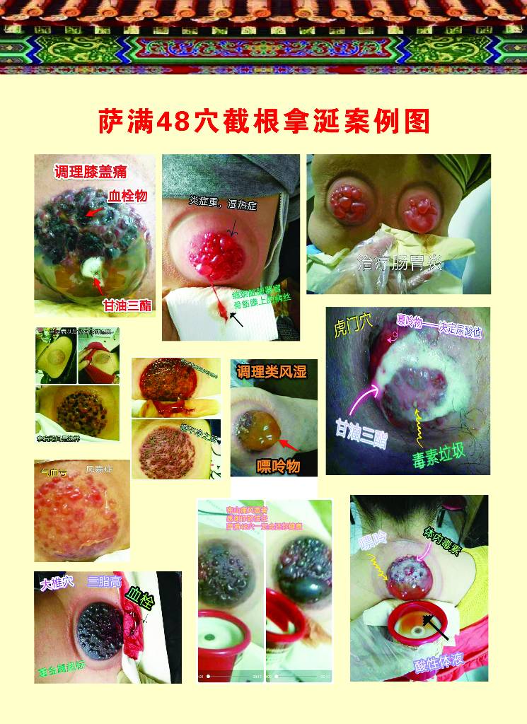 不打针!不手术!